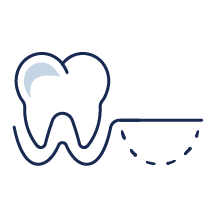 Icon of a tooth for bone grafting