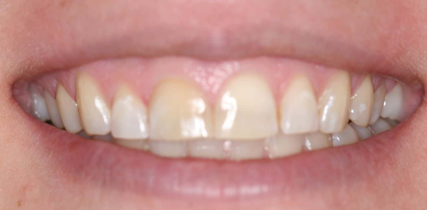 Inspiring Smile Transformations - Marc A. Minch, DMD